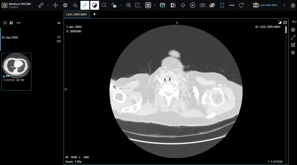 Medical DICOM Viewer Desktop
