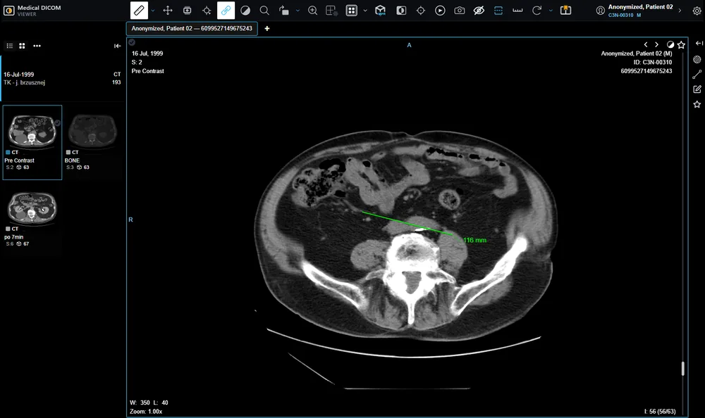 Medical DICOM Viewer (Web)